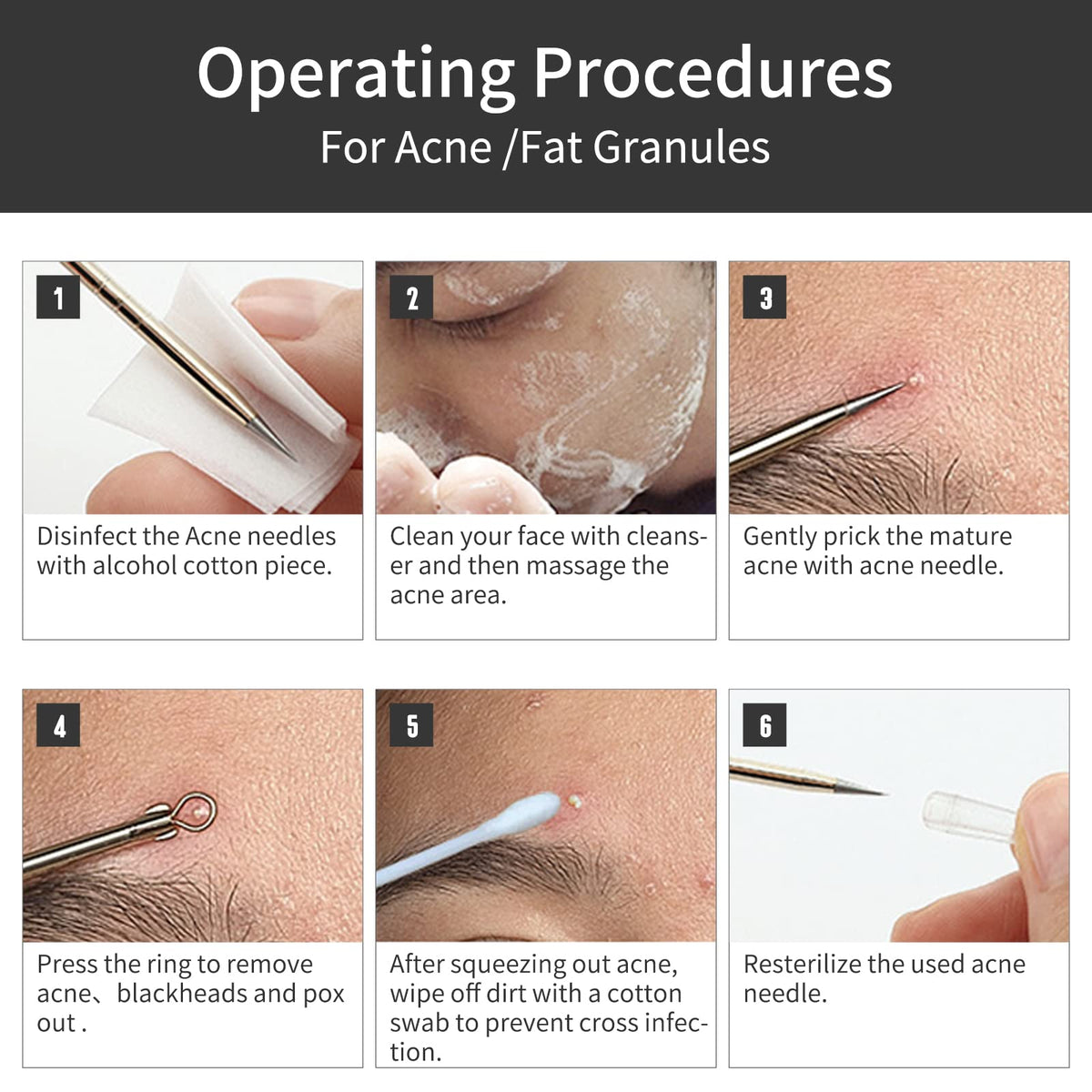 GERY Blackhead Remover Pimple Popper Tool Kit, 8 PCS Professional Stainless Steel Acne Needles, Comedone Extractor Whitehead Removal, Zit Popping Treatment & Pore Cleaner Set with Leather Case