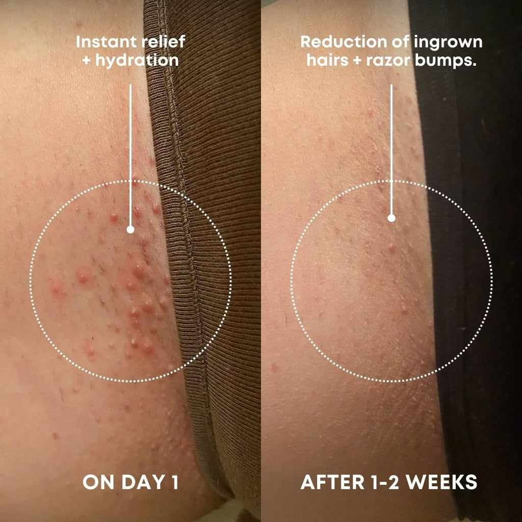 Bushbalm Ingrown Hair Exfoliating Scrub - Reduces Appearance of Ingrown Hairs and Razor Bumps, Soothes Skin and Post-Shave Redness - Nude, 236 ml