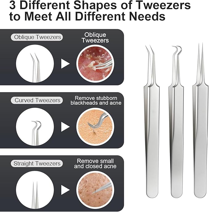 8PCS Professional Salon Grade Blackhead Remover Tool Kit, Comedone Extractor Set for Facial Acne Pimple Blemish Whitehead, Comes with 10X Magnifying Mirror & 20 Alcohol Prep Pads