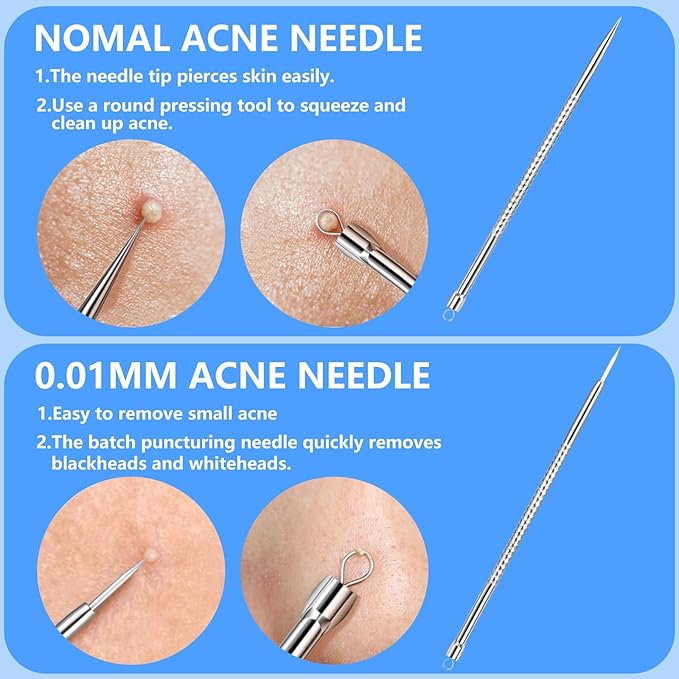 AskBed 5PCS Blackhead Remover Comedone Extractor Kit