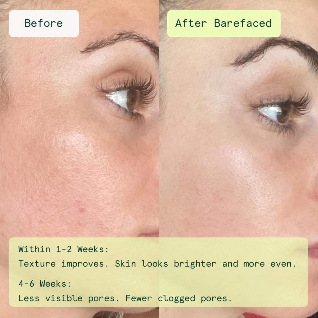 Barefaced Toning and Exfoliating Pads | Glycolic and Salicylic Acid Face Wipes for Blemishes, Dark Spots, and Uneven Texture | Daily Resurfacing Peels for Clear, Glowing Skin (60 Pads)