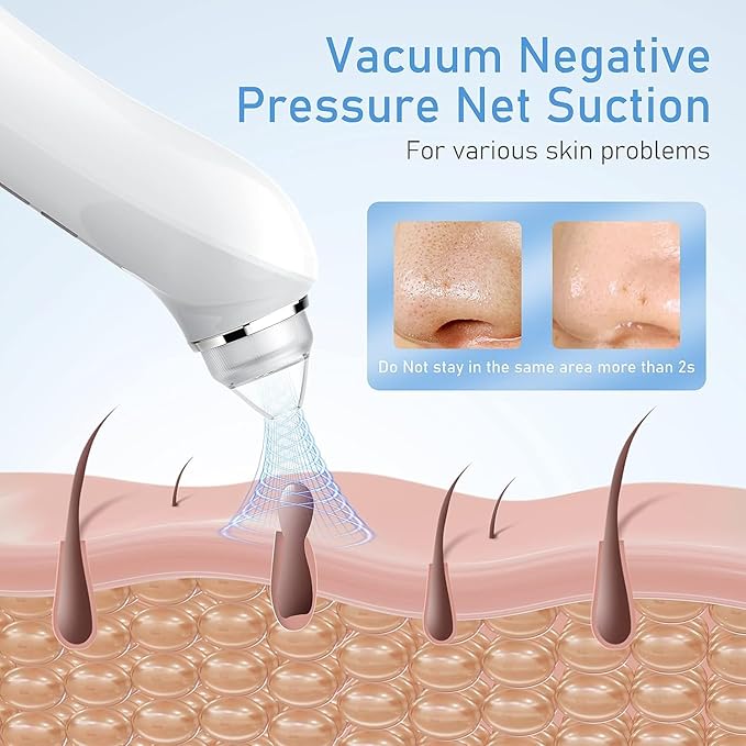 Blackhead Remover Vacuum, USB Interface Type Pore Vacuum, Black Head Extractions Tool with Camerafor, Men and Women Pore Cleaner, 3 Adjustment Modes & 6 Suction Heads(Light Pink)