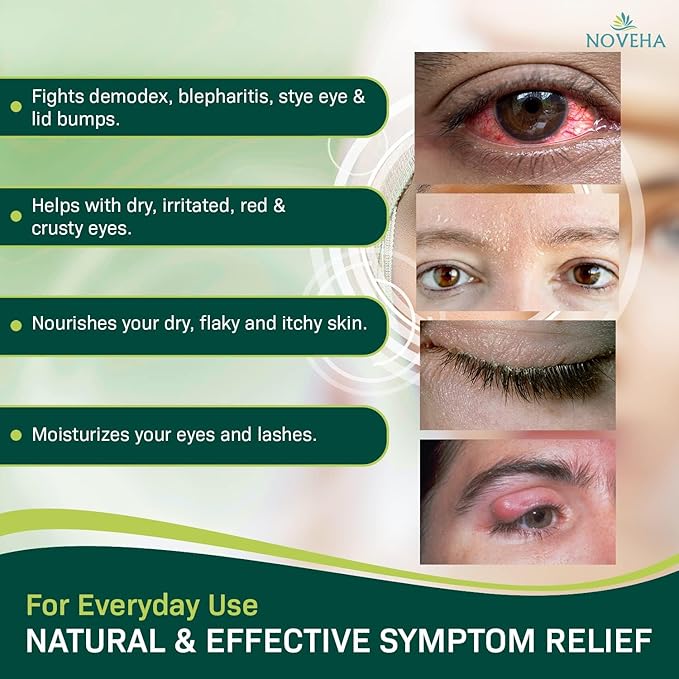 NOVEHA Extra Strength Tea Tree Eyelid & Face Foaming Cleanser – Daily Cleansing Foam with Tea Tree Oil, Coconut Oil, Vitamin E & Pro-Vitamin B5 – For Eyelids, Lashes & Face – 3.38 fl oz (3 Pack)