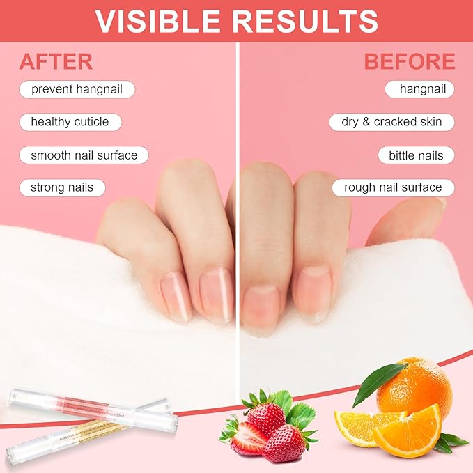 Meschett 3PCS Nail Cuticle Oil Pens with Nail File, Natural Cuticle Oil for Nail Care, Moisturizing Nail Oil for Dry Nails & Cuticles (Orange & Strawberry & Aloe Scent)