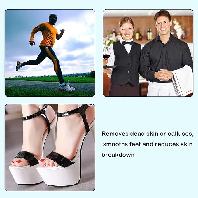 Xvnoesza 2Pcs Professional Dual Sided U Shaped Foot File Foot Files for Hard Skin Foot Scraper Rasp Dry Skin Remover Feet Dead Skin Remover for Feet