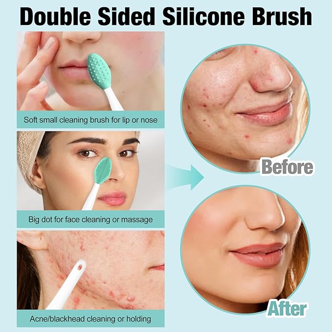 MUIIGOOD 3Pcs Blackhead Remover Pimple Popper Tool Kit Pimple Extractor Acne Treatment Surgical Grade Blackhead Comedone Removal Popper Tool Cleaning Brush for Face Nose Lips