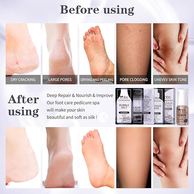 nbc BeautiLab Pedicure Foot Soak Set - Upgraded 6 in 1 Foot Spa, Foot Bath Spa, Pedicure Kit, Foot Soak for Tired & Dry Cracked Feet, Athletes Feet, Bad Odor, Softens Calluses,Golden Petals