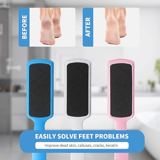 Fu Store Pedicure Foot Files Callus Remover with Double Sided Feet Rasp for Dead Skin Professional Scrubber for Feet (6 Pack)
