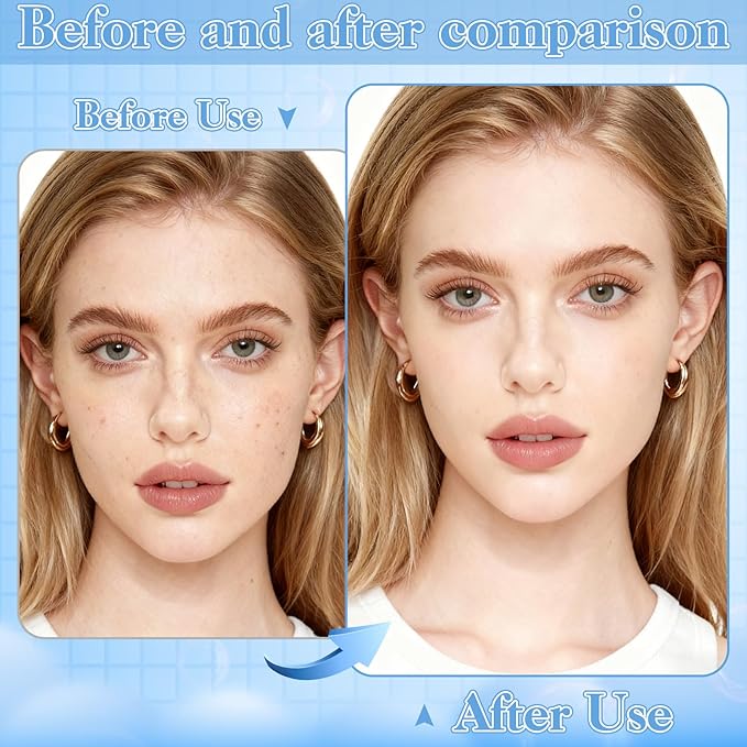 HairChrysm 9 PCS Blackhead Extraction Tool Kit, Blackhead Remover Tool Comedones Extractor Acne Removal Kit for Nose Face