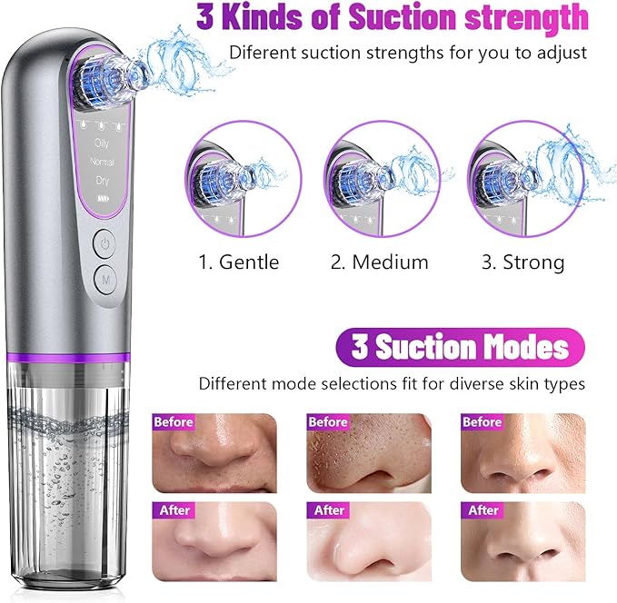 Blackhead Remover Vacuum with Microbubble Cleaning, Facial Pore Extractor & Pro Cleanser Tool, 3 Suction Levels, 5 Replaceable Heads for Deep Cleansing & Skin Care