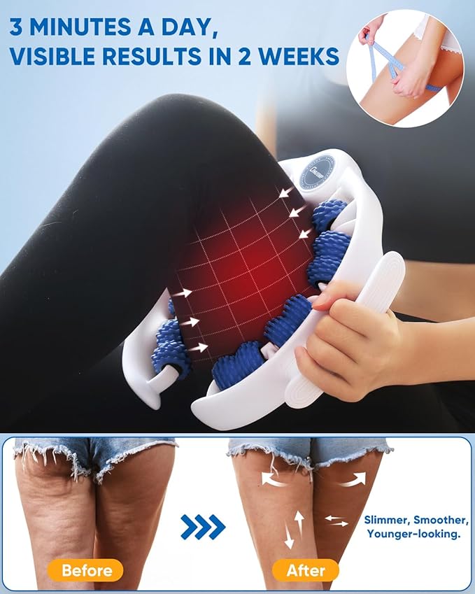 ONUEMP Cellulite Massage Tool, Lymphatic Drainage Cellulite Remover for Legs, Muscle Roller Fascia Massage - Body Sculpting, Lipedema Massagers, Celulitis Reduccion, Deep Tissue Pain Relief, Blue