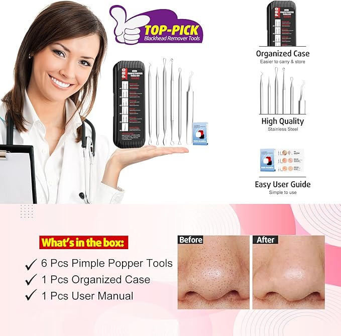 Cbiumpro 6 Pack Blackhead Remover Tools, Pimple Popper Tool Kit, Professional Blackhead Extractor for Zit, Acne, Whitehead, Comedone on Nose - with Case