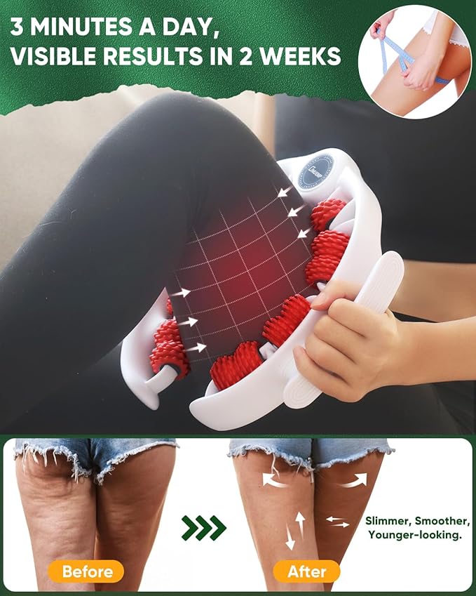 ONUEMP Cellulite Remover for Legs, Cellulite Massager Roller Muscle Roller, Fascia Massage Tool Thigh, Calf, Leg Massager - Anti-Celulitis, Lymphatic Drainage, Body Sculpting, Deep Tissue Pain Relief