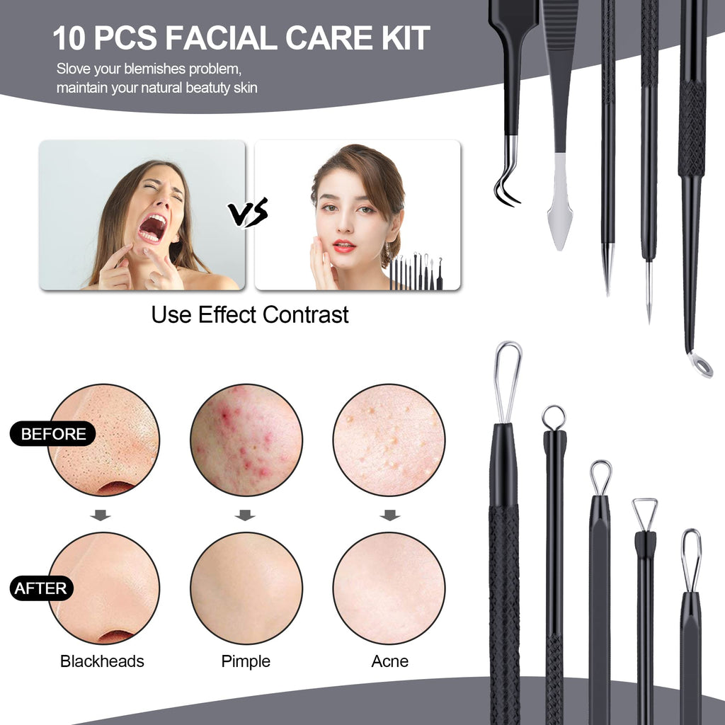 MENOLY Pimple Popper Tool Kit 10 Pcs Blackhead Remover Tool Zit Popper for Blemish, Pimple Comedone Extractor Acne Tool for Blackheads, Acnes, Whiteheads Nose Face Tools with Leather Bag