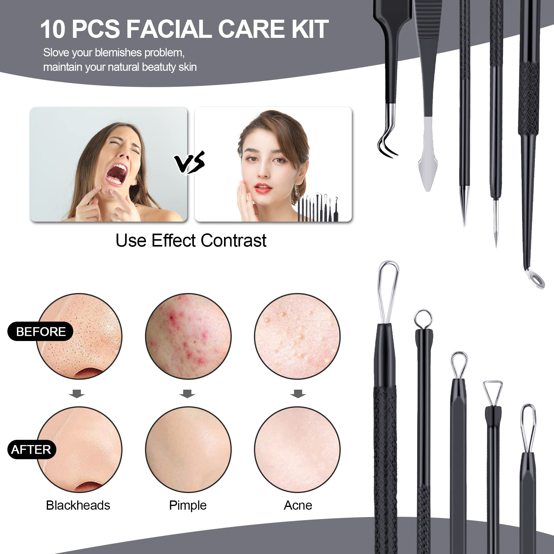 MENOLY Pimple Popper Tool Kit 10 Pcs Blackhead Remover Tool Zit Popper for Blemish, Pimple Comedone Extractor Acne Tool for Blackheads, Acnes, Whiteheads Nose Face Tools with Leather Bag