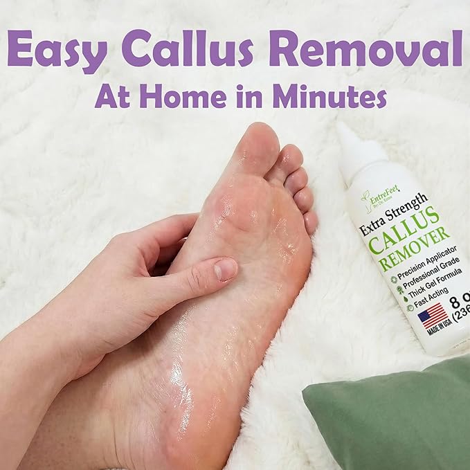 Callus Remover for Feet (Extra Strength 8 oz) Foot Callus Remover Gel, Spa Foot Care, Pedicure Tools for Feet Scrubber