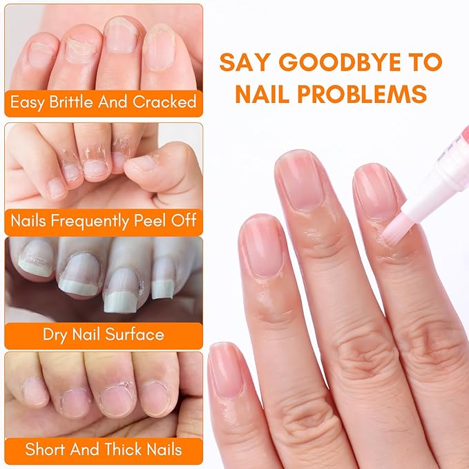 Makartt Cuticle Oil Pen Nail Care: 12pcs Repair and Softener with Vitamin E, Moisturizer Kit for Acrylic Nails, Art Accessory for Manicure and Pedicure, DIY Home Salon Use