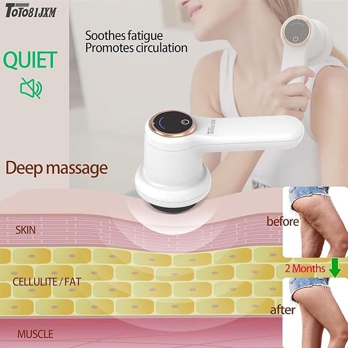 TOTO81JXM Electric Cellulite Massager – Body Sculpting Machine with 8 Massage Heads, Lymphatic Drainage & Skin Tightening for Belly Stomach Leg, Lipo Roller Massager After Surgery, Adjustable Speed.