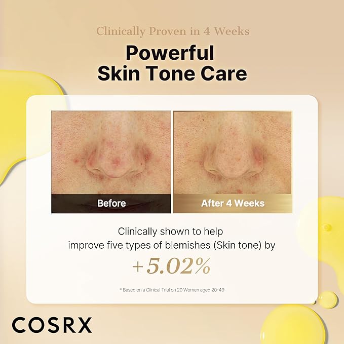 COSRX Advanced Pure Vitamin C 23% Serum with Vitamin E & Glutathione (Renewal), Korean Vitamin C Serum for Fine Lines, Uneven Skin Tone & Dull Skin, 0.7oz, Korean Skin Care