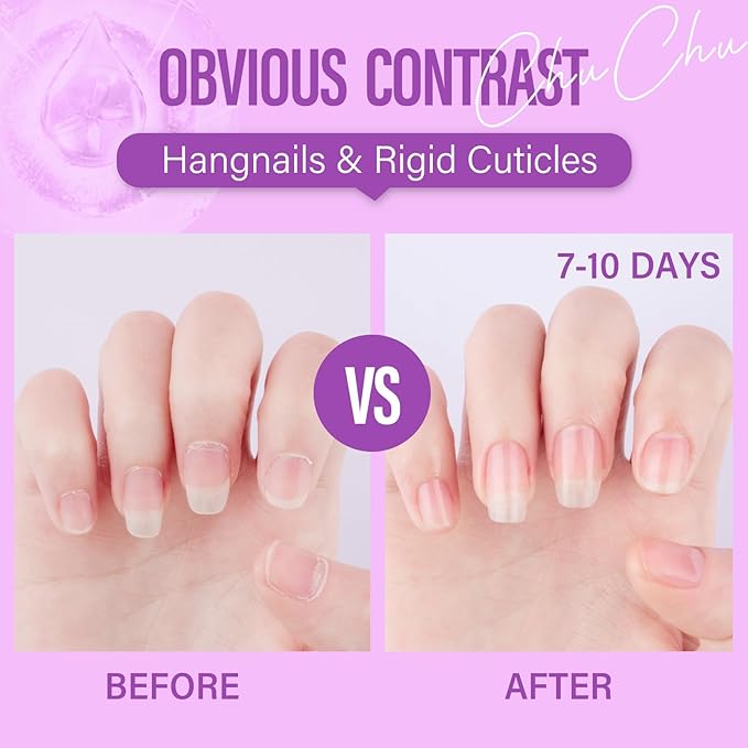 CHUCHU Vegan Cuticle Oil for Nails: Blueberry Jojoba Nail Cuticle Oil with Vitamin B & E for Moisturizes Cuticle and Nail's Skin - Prevents Hangnails and Chapped 15ML