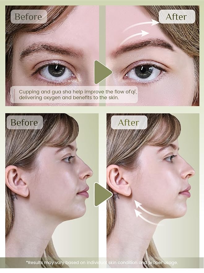 Rena Chris Facial Cupping Set & Gua Sha Tool - Jade Stone, Silicone Facial Cupping, Puffiness & Lip Plumping Therapy for Natural Skin Care