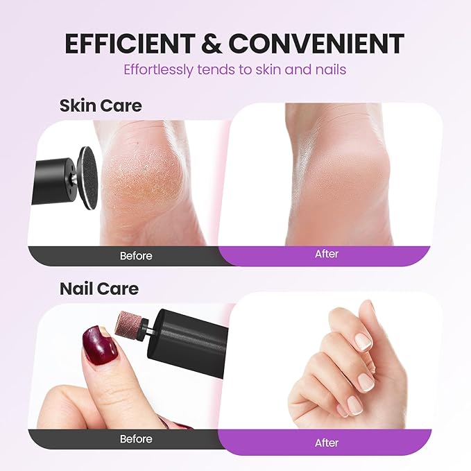 Electric Foot Callus Remover, 2 in 1 | 6 Speed Adjustable Foot File Nail Grinder with Sandpaper Disks, Professional Sander Pedicure Tool for Feet Dead Skin, Self Care Gifts for Women Mom Lover Friends