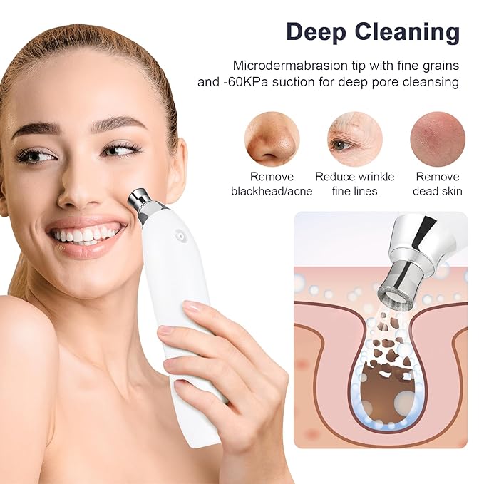 Microdermabrasion Machine, 7 Suction Modes with 9 Diamond Tips and Airbrush