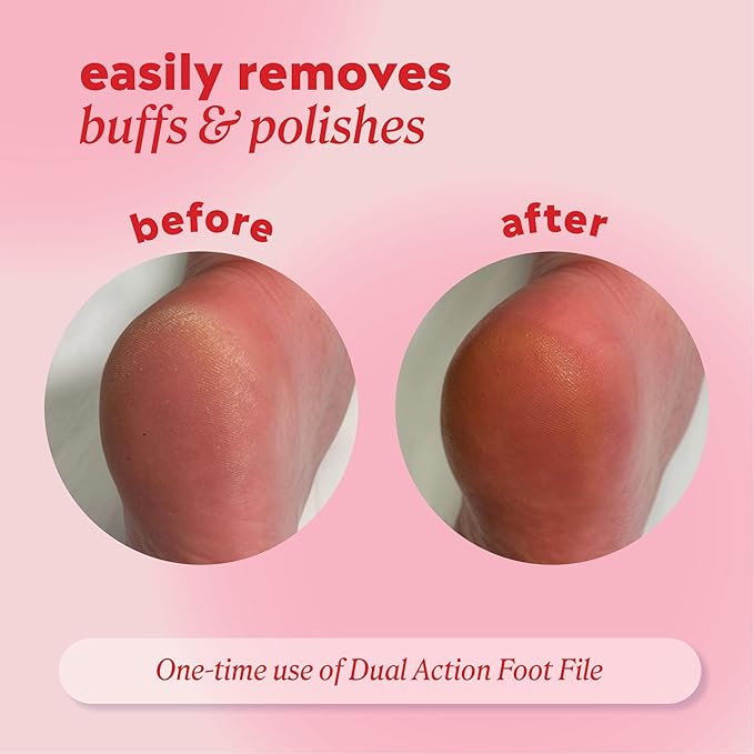 ONYX Professional Stainless Steel Dual Action Foot Polisher, Durable Stainless Steel Foot File for Dry Skin and Foot Callus Removal, 1 Pack