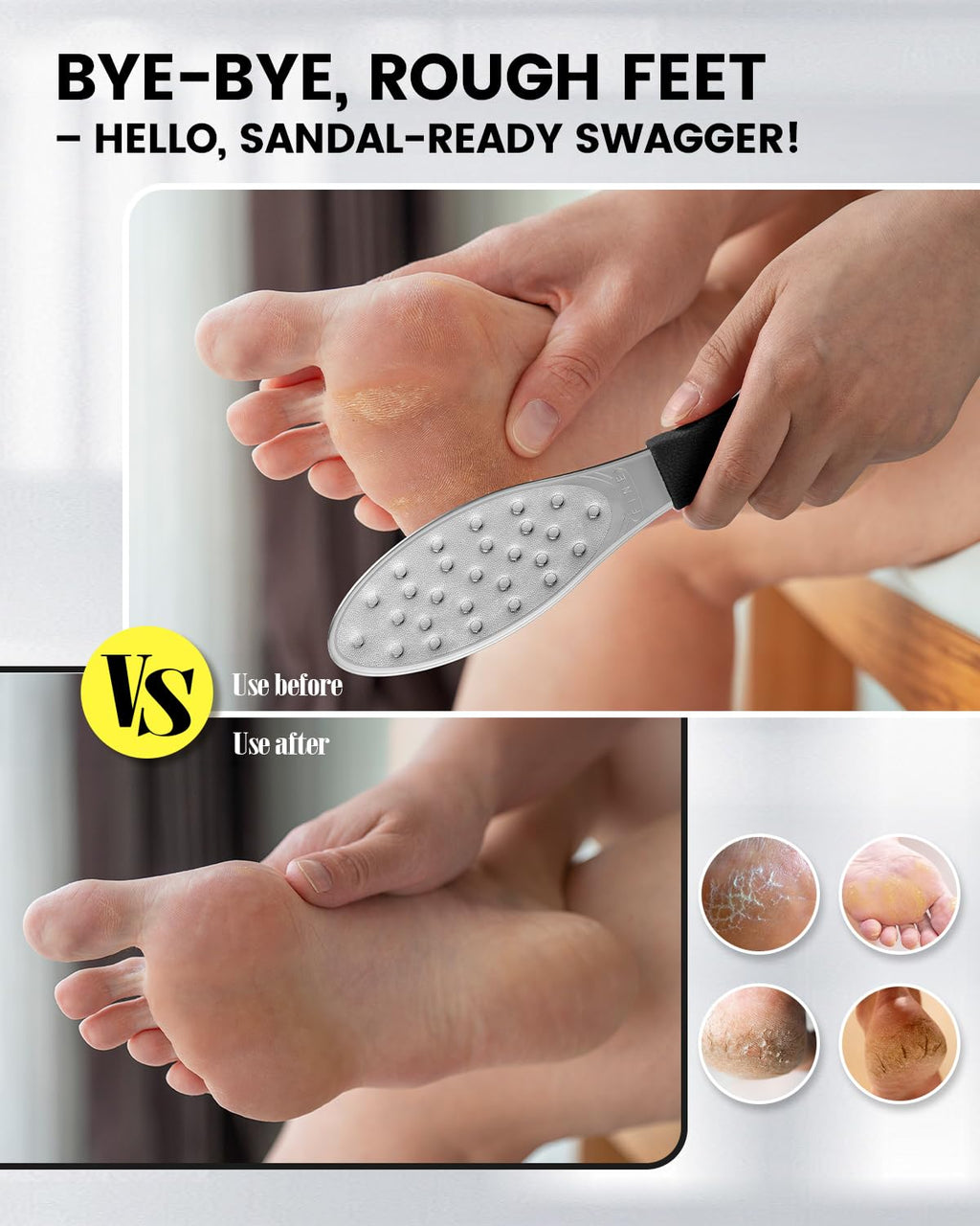 BEZOX Slim Portable Metal Foot File(1 PCS) – Double-Sided Callus Remover for Feet, Travel Foot Scrubber & Foot Exfoliate Tool with Non-Slip Handle, Pedicure Tools for Feet - Black