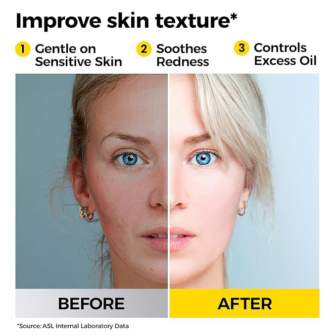 Face Towels, Disposable Clean Towels, Extra Thick, Hypoallergenic for Sensitive Skin, Unscented Lint-Free, Dry Wipes for Cleansing & Makeup, Dual-Textured AB Sides, Travel, 50 Counts (1 Pack)