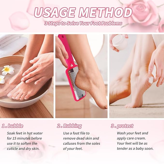 Foot Callus Remover – Professional Stainless Steel Foot File for Dead Skin, Callus & Hard Skin Removal – Ergonomic Design for Smooth, Baby-Soft Feet (Red)