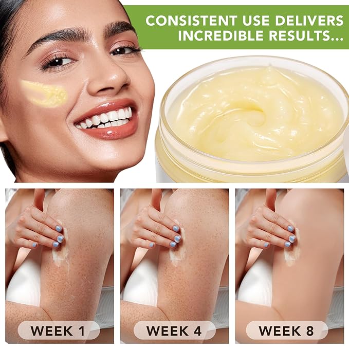 Organic Raw Shea Butter, 100% Pure & Unrefined - For Intense Moisture on Dry Skin, Hair & Lips, Natural DIY Body Butter Base, Rich in Vitamins A, E, F, 7.8 oz
