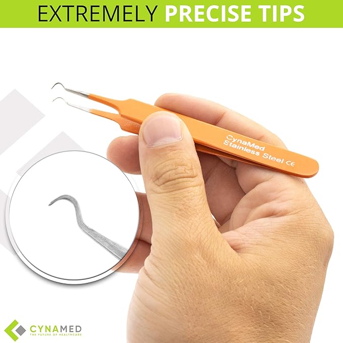 Blackhead Tweezer - Professional Curved Steel Tip Surgical Comedone & Splinter Extractor. Ideal Blemish & Acne Remover Tool Means Flawless Facial Skin (Orange)