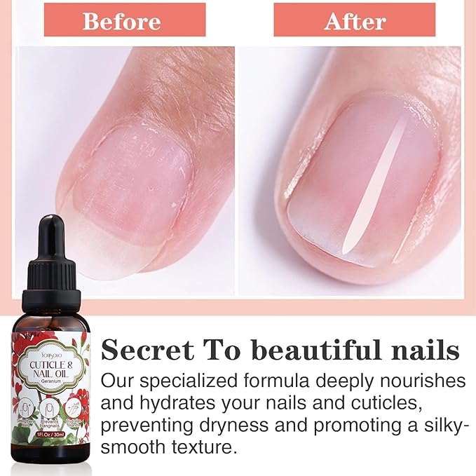 yonisayo 3 PCS Geranium Cuticle Oil for Nails Care, Healthier-Looking Nails, Soften Cuticles, Strengthen Nails, Hydrating Hand Oil