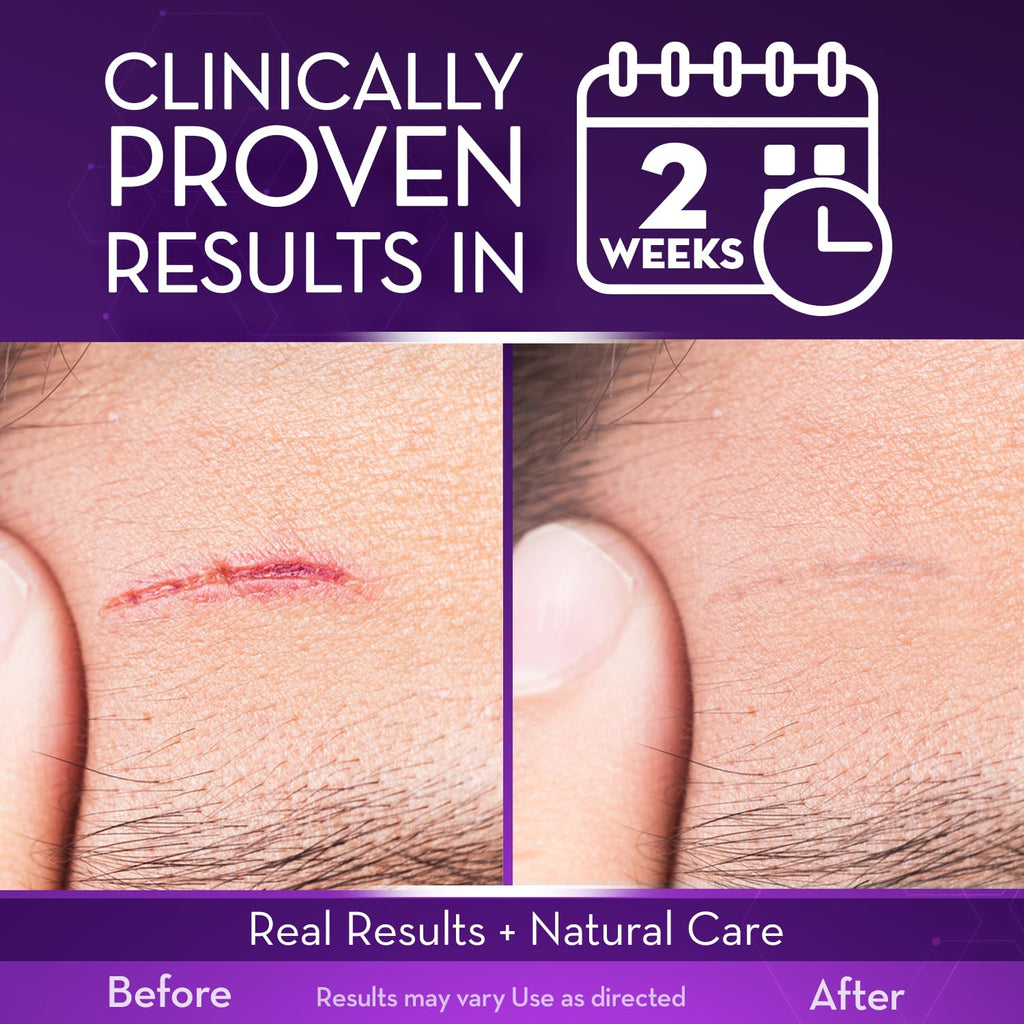 Cicatricure Advanced Scar Gel, Proven Results in 2 Weeks, 1 oz (28 g), 2pk