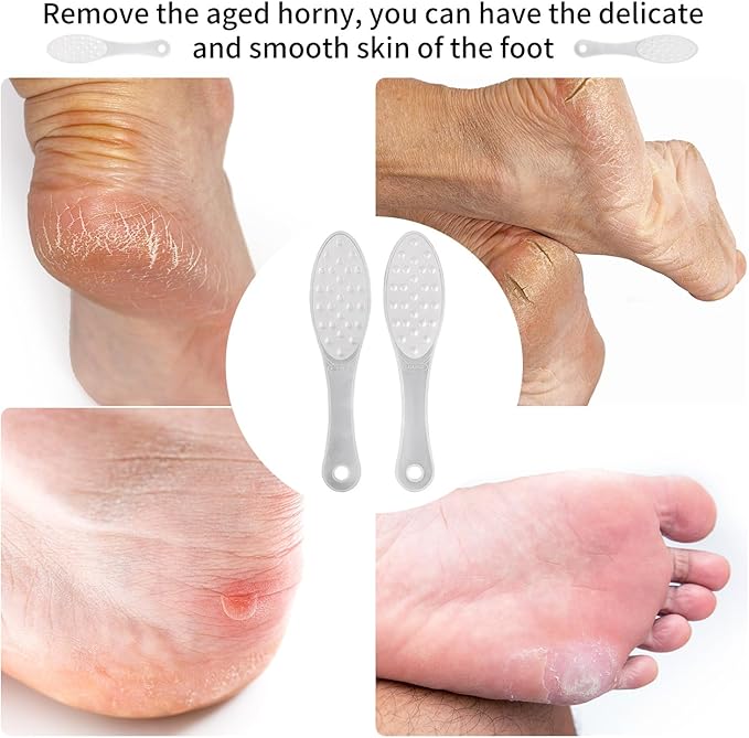 2PCS Stainless Steel Foot Scraper,Professional Foot Rasp Scrubber,Double Sided Pedicure Rasp for Cracked Heel and Dead Foot Skin, Easy to Clean Pedicure Tool(Silver)