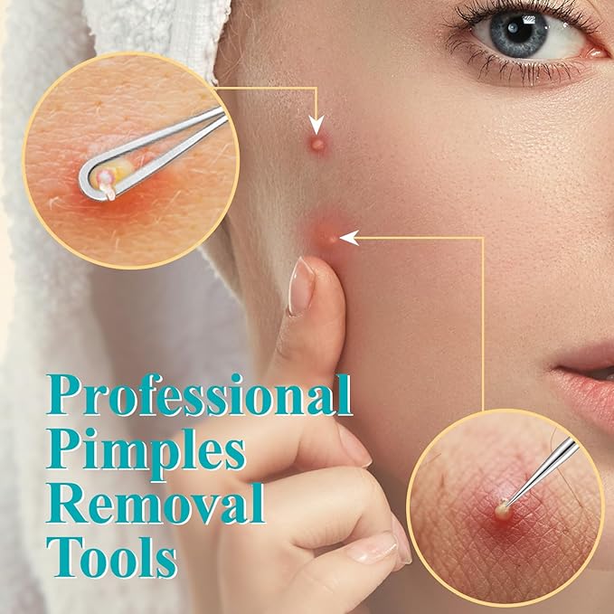 Tweezers for Women Facial Hair, 10 in 1 Pimple Popper Tool Kit
