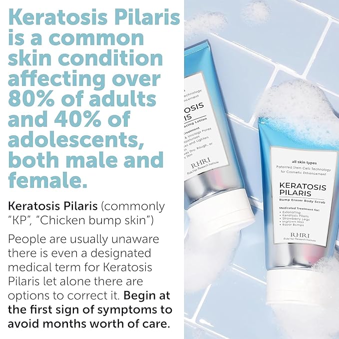 KP Bump Eraser Body Set with 10% AHA | Keratosis Pilaris Treatment | Keratosis Pilaris Lotion | Exfoliating Body Scrub | Bundle Set for Bump, Strawberry Legs, Redness, Dryness