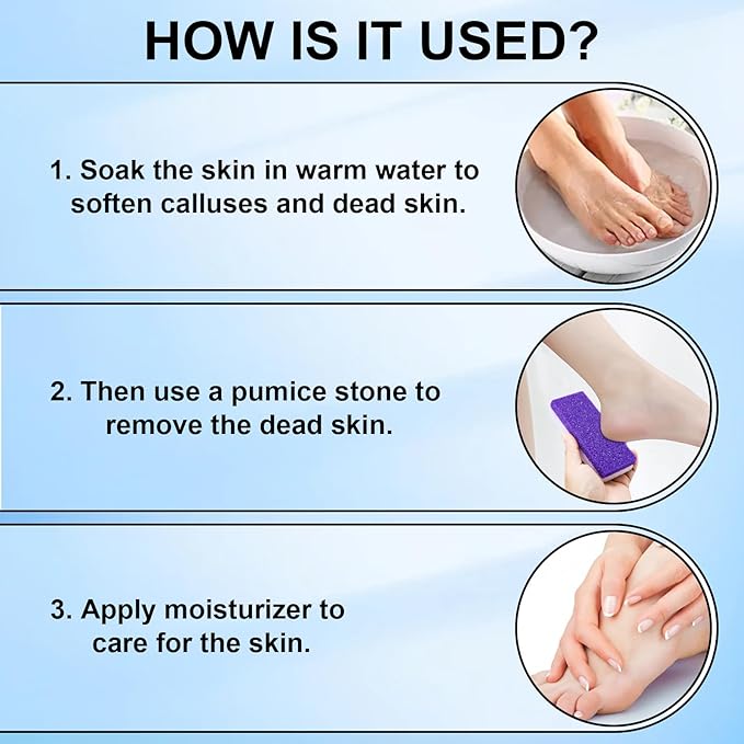 Foot Pumice Stone 2 Pack Pedicure Stone for Feet Pumice Sponge for Feet Callus Remover and Scrubber Double Sided Pedicure Foot Pumice Stone for Feet and Heels Callus and Dead Skins (Purple)