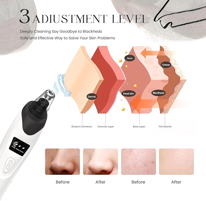 2026 Blackhead Remover Pore Vacuum,Facial Pore Cleaner-5 Suction Power,5 Probes,USB Rechargeable Blackhead Vacuum Kit Electric Pore Vacuum Tool for Adult(Black)