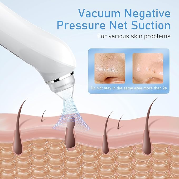 Black Head Extractions Tool