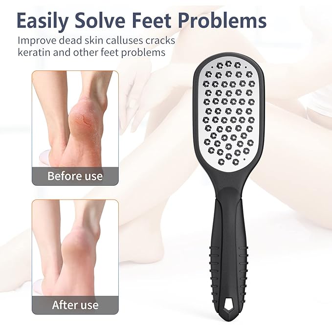 Foot Rasp Foot File and Callus Remover. Professional Foot Care Pedicure Stainless Steel File to Remove Hard Skin. Can Be Used On Both Wet and Dry Feet. -AsonTao