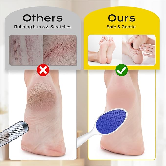 Foot File, Nano Glass Foot File Callus Remover with Handle, 2-in-1 Foot Scrubber Dead Skin Remover, Gentle Exfoliation Foot Buffer Pedicure Tools for Feet-Blue
