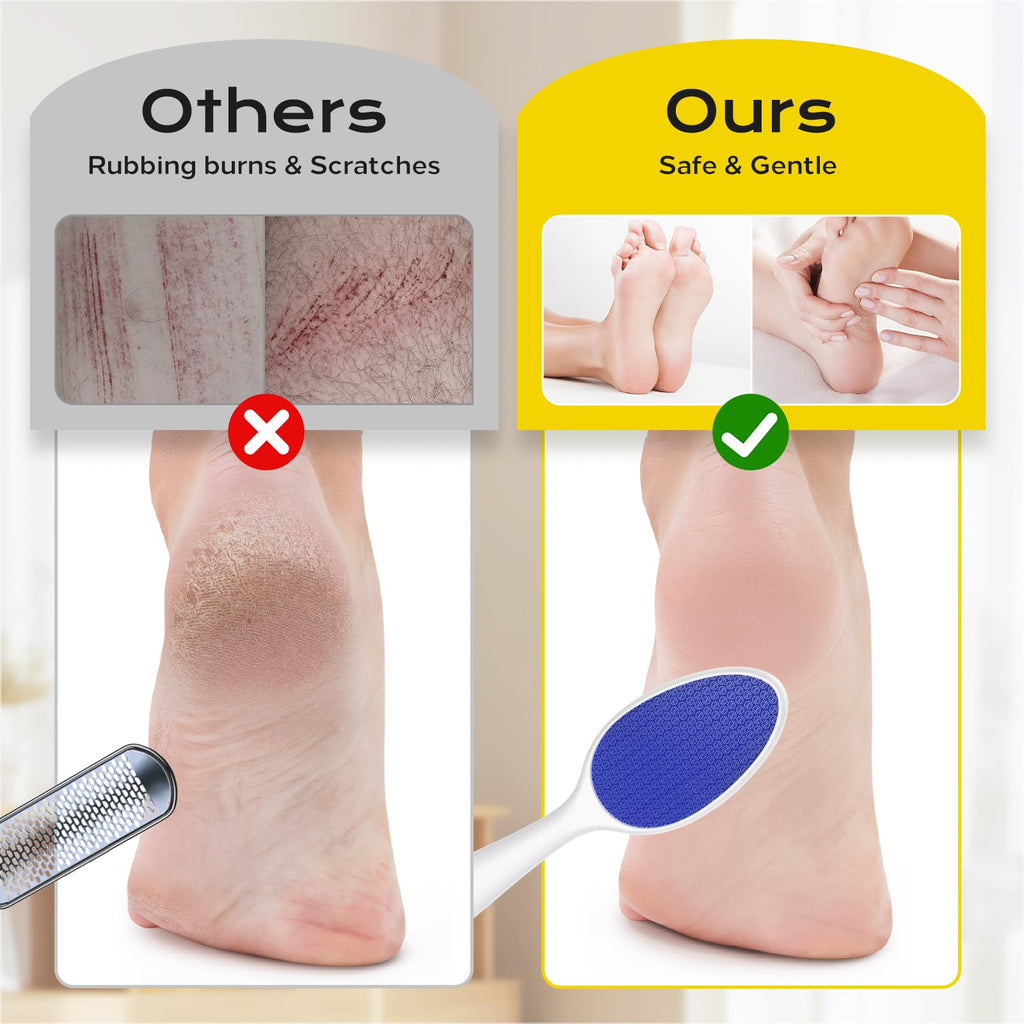 yomanta Foot File, Nano Glass Foot File Callus Remover with Handle, 2-in-1 Foot Scrubber Dead Skin Remover, Gentle Exfoliation Foot Buffer Pedicure Tools for Feet-Blue