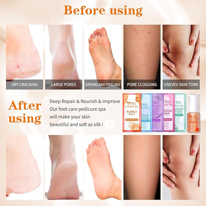 nbc BeautiLab Pedicure Foot Soak Set - Upgraded 6 in 1 Foot Spa, Foot Bath Spa, Pedicure Kit for Tired & Dry Cracked Feet, Athletes Feet, Bad Odor, Softens Calluses (Orange)