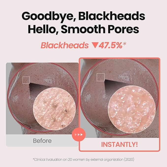 [K-Beauty] Rose Vitamin Revitalizing Oil to Foam - All-in-One Korean Face Wash Oil-Based Foaming Facial Cleanser - Pore Minimizing & Blackhead Remover - Makeup Cleansing for All Skin Types 3.88 fl oz
