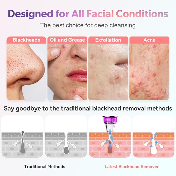 2026 Blackhead Remover Pore Vacuum, 5 Adjustable Suction Levels, 5 Probes, USB Rechargeable