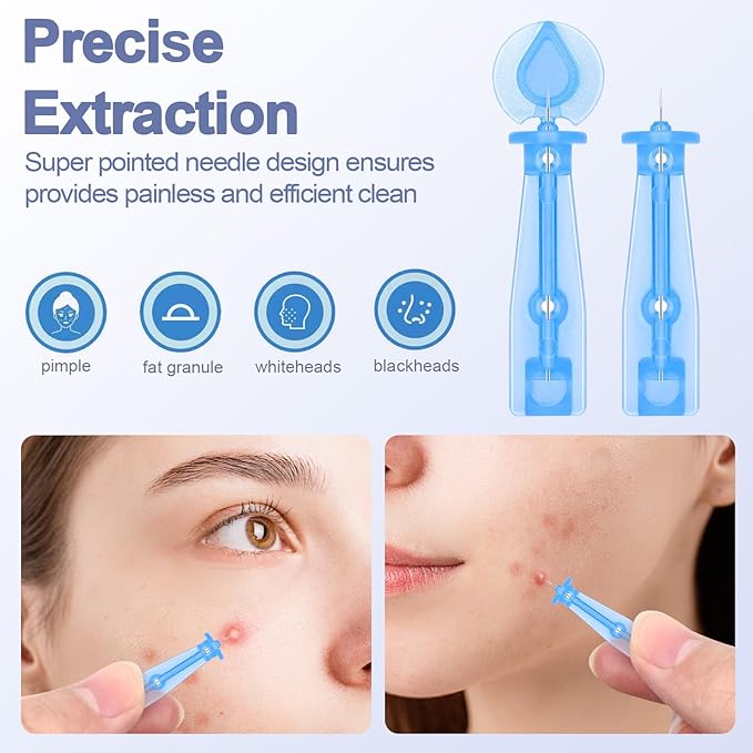 100 Pack Disposable Acne Pimple Popper Needles and 144 Dots Acne Pimple Stickers, for Whitehead Closed Mouth Clear (100 Pack)
