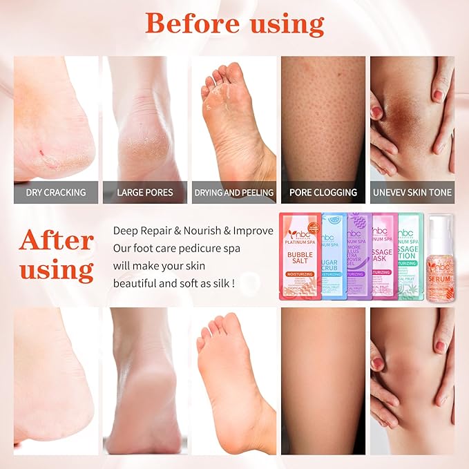 nbc BeautiLab Pedicure Foot Soak Set - Upgraded 6 in 1 Foot Spa, Foot Bath Spa, Pedicure Kit, Foot Soak for Tired & Dry Cracked Feet, Athletes Feet, Bad Odor, Softens Calluses (Tropical fruit)