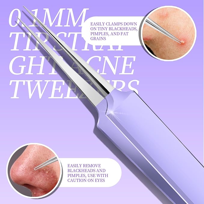 Teenitor Pimple Popper Tool Kit and Blackhead Remover Tools, Ingrown Hair Tweezers, Professional Blackhead Extractor Pimple Extractor Comedone Extractor